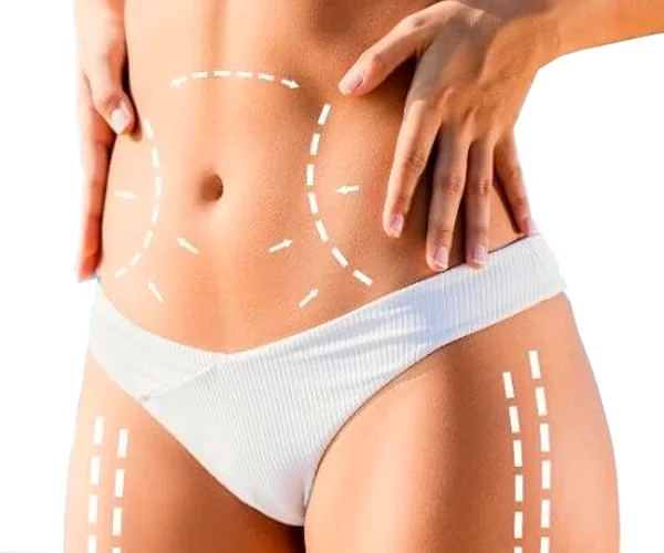 Lipo com dr Guilherme